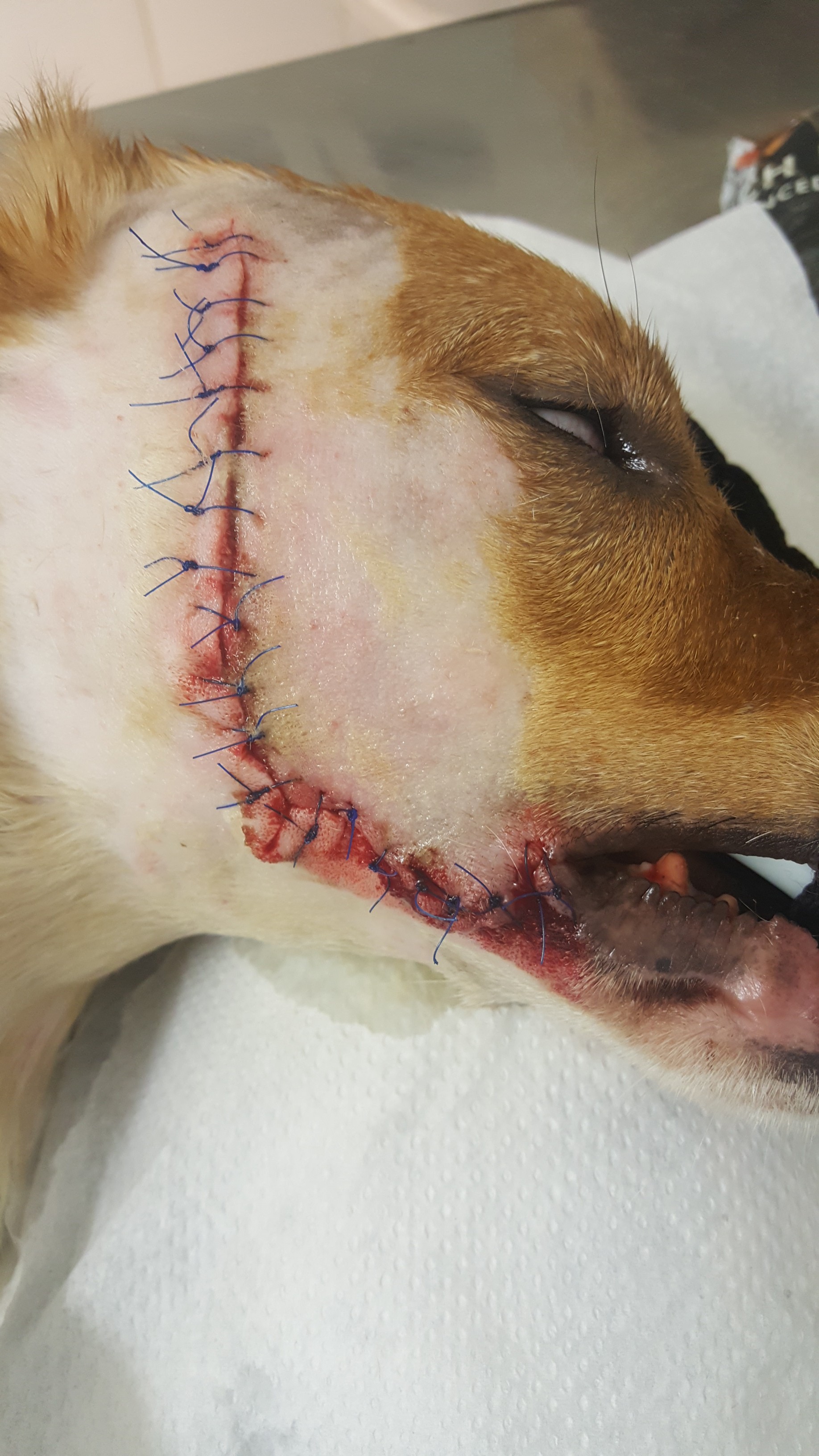 Just out of surgery
